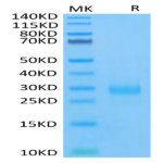 Human CD160 Protein (CD1-HM460)