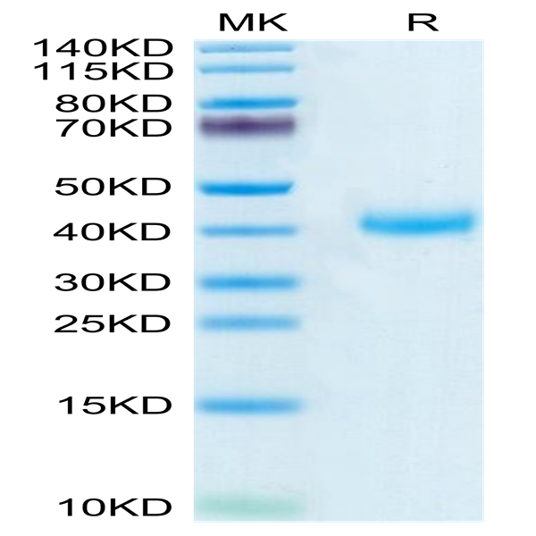 Biotinylated Human CD161 Protein (CD1-HM461B)