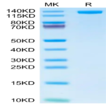 Human CD163 Protein (CD1-HM463)