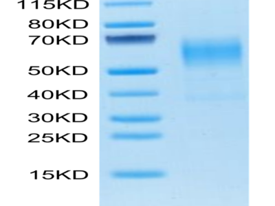 Mouse CD19 Protein (CD1-MM119)