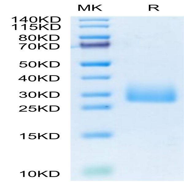 Mouse CD161 Protein (CD1-MM161)