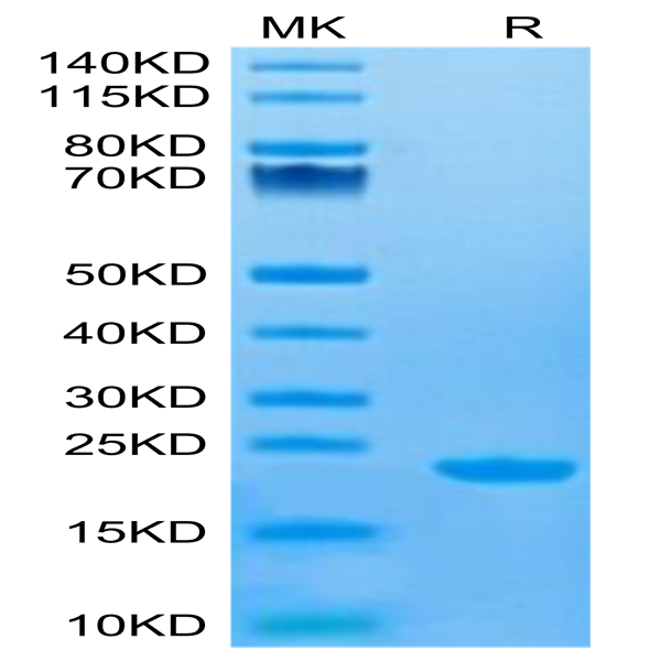Human CD20/MS4A1 Protein (CD2-HE120)
