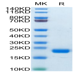 Biotinylated Human CD20/MS4A1 Protein (CD2-HE120B)