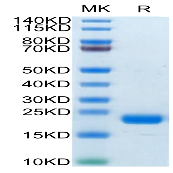 Biotinylated Human CD20/MS4A1 Protein (CD2-HE120B)