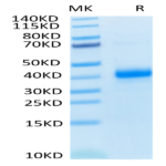 Human CD2/SRBC Protein (CD2-HM102)