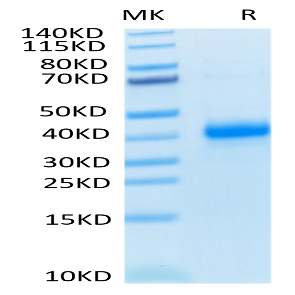 Human CD2/SRBC Protein (CD2-HM102)