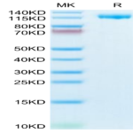 Human CD21 Protein (CD2-HM121)