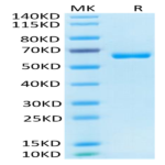 Human CD2/SRBC Protein (CD2-HM202)