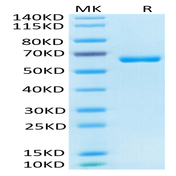 Human CD2/SRBC Protein (CD2-HM202)