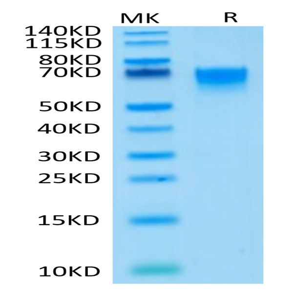 Human CD27/TNFRSF7 Protein (CD2-HM227)
