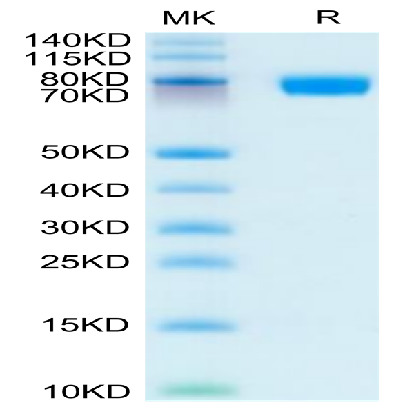 Human CD200 R1/CRTR2 Protein (CD2-HM2R1)