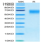 Human CD200 R1/CRTR2 Protein (CD2-HM4R1)