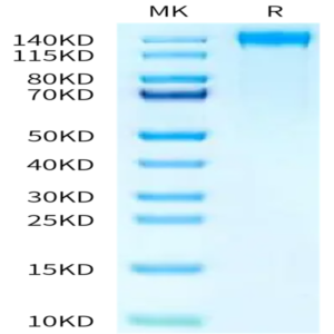 Mouse CD21 Protein (CD2-MM121)