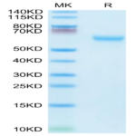 Mouse CD27/NFRSF7 Protein (CD2-MM327)