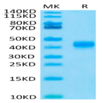 Human CD23/Fc epsilon RII Protein (CD3-HM123)
