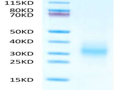Human CD37 Protein (CD3-HM137)