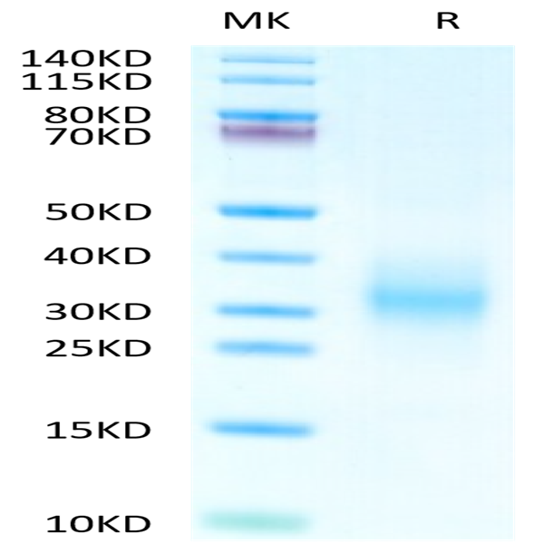 Human CD37 Protein (CD3-HM137) Human CD37 Protein (CD3-HM137)