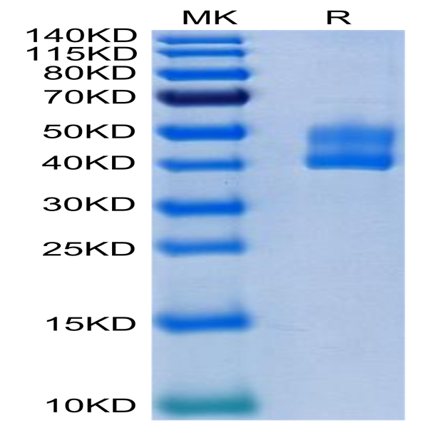 Human CD3E&CD3D/CD3 epsilon&CD3 delta Protein (CD3-HM205)