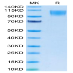 Human CD30/TNFRSF8 Protein (CD3-HM230)