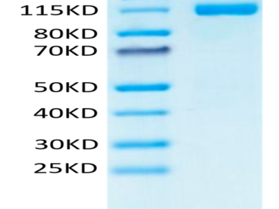 Human CD31/PECAM-1 Protein (CD3-HM231)