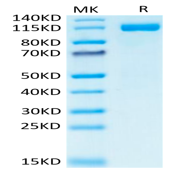 Human CD31/PECAM-1 Protein (CD3-HM231) Human CD31/PECAM-1 Protein (CD3-HM231)