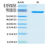 Human CD38 Protein (CD3-HM238)