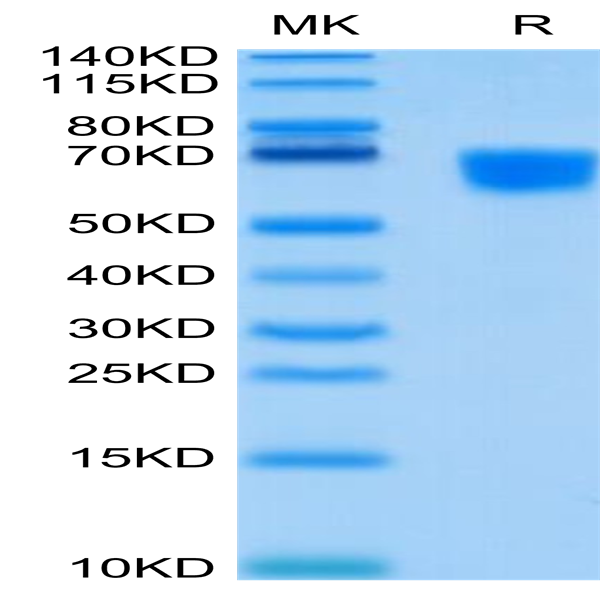 Human CD30 Ligand/TNFSF8 Protein (CD3-HM30L)