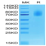 Biotinylated Human CD30/TNFRSF8 Protein (CD3-HM430B)