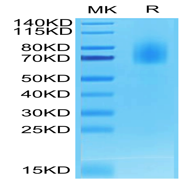 Biotinylated Human CD30/TNFRSF8 Protein (CD3-HM430B)