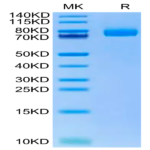Human CD36/SR-B3 Protein (CD3-HM436)