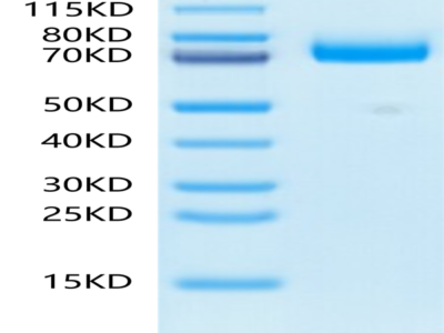 Mouse CD36/SR-B3 Protein (CD3-MM136)