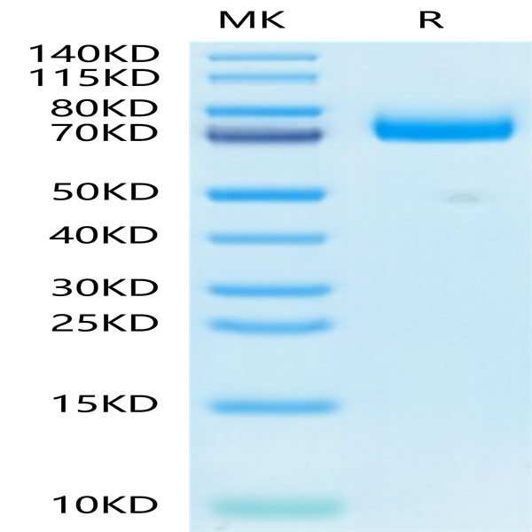 Mouse CD36/SR-B3 Protein (CD3-MM136) Mouse CD36/SR-B3 Protein (CD3-MM136)