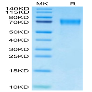 Mouse CD39/ENTPD1 Protein (CD3-MM139)