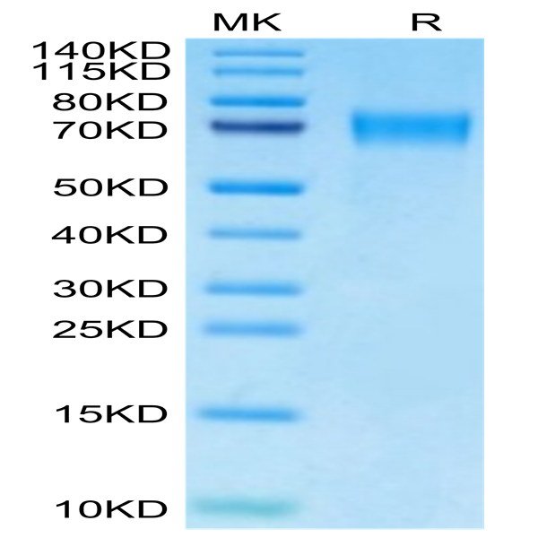 Mouse CD39/ENTPD1 Protein (CD3-MM139)