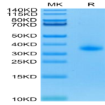 Human CD40/TNFRSF5 Protein (CD4-HM140)