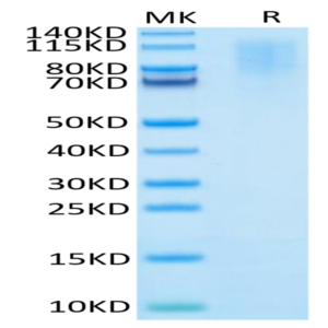 Human CD43 Protein (CD4-HM143)