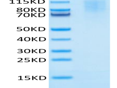 Human CD43 Protein (CD4-HM143)