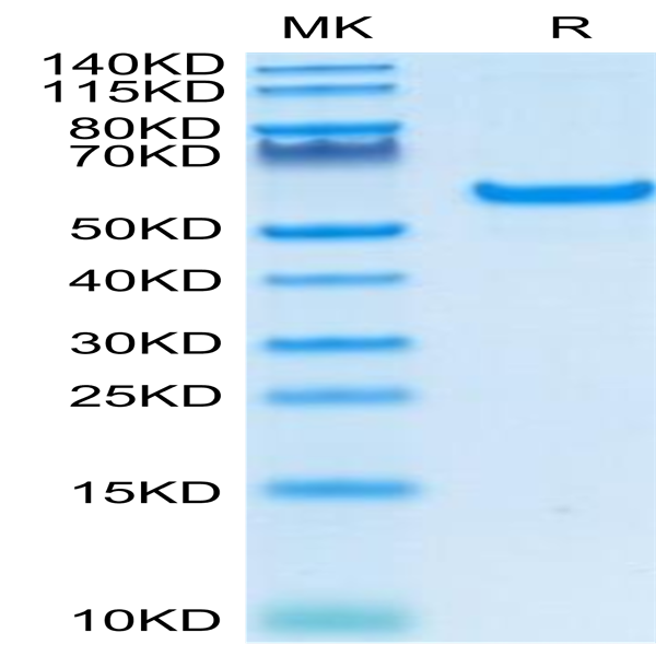 Human CD40/TNFRSF5 Protein (CD4-HM240)