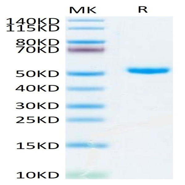 Human CD4/LEU3 Protein (CD4-HM401)