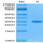 Mouse CD40/TNFRSF5 Protein (CD4-MM140)