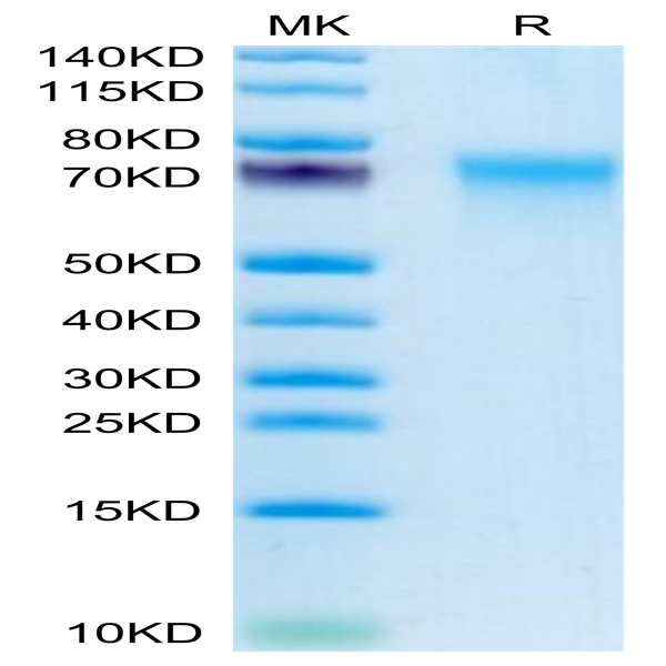 Human CD55 Protein (CD5-HM105)