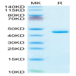 Human CD5L Protein (CD5-HM10L)