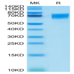 Human CD58 Protein (CD5-HM208)