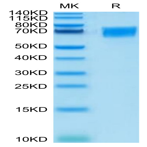 Human CD58 Protein (CD5-HM208)