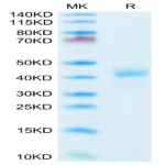 Human CD52 Protein (CD5-HM252)