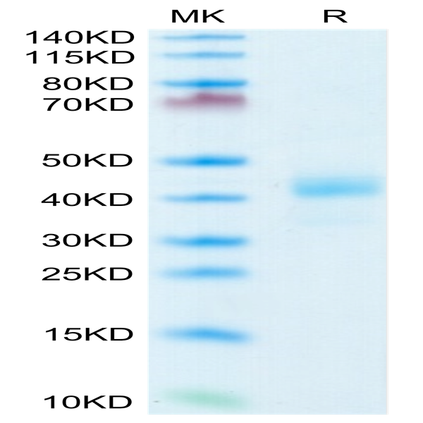 Human CD52 Protein (CD5-HM252)