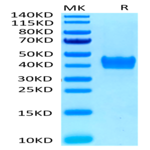 Human CD52 Protein (CD5-HM352)