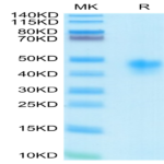 Human IL-2 R alpha/CD25 Protein (CD5-HM425)