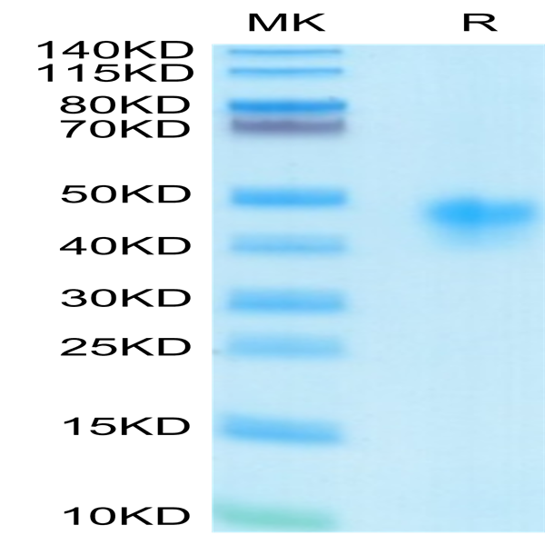 Human IL-2 R alpha/CD25 Protein (CD5-HM425)