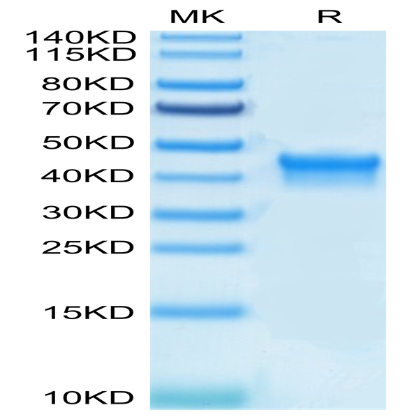 Biotinylated Human IL-2 R alpha/CD25 Protein (CD5-HM425B)